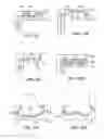 Fig. 32 - Joint arthroplasty devices and surgical tools