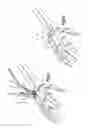 Fig. 02 - Reamer guide systems and methods of use