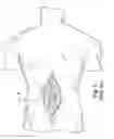 Fig. 02 - Instrumentation and method for mounting a surgical navigation reference device to a patient