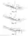 Fig. 07 - SUTURE SYSTEM AND ASSEMBLY INCLUDING A LEADER PLUG