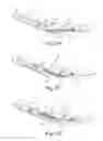Fig. 08 - SUTURE SYSTEM AND ASSEMBLY INCLUDING A LEADER PLUG