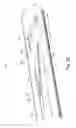 Fig. 18 - ENDOSCOPIC TISSUE APPOSITION DEVICE WITH MULTIPLE SUCTION PORTS