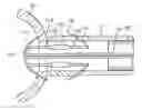 Fig. 01 - Method and apparatus for anastomosis