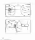 Fig. 11 - Methods for facilitating tissue puncture