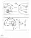 Fig. 12 - Methods for facilitating tissue puncture