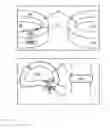 Fig. 14 - Methods for facilitating tissue puncture