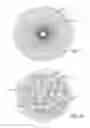 Fig. 08 - Multiple layer filamentary devices for treatment of vascular defects