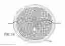 Fig. 12 - Multiple layer filamentary devices for treatment of vascular defects