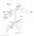 Fig. 13 - Multiple layer filamentary devices for treatment of vascular defects