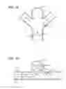 Fig. 14 - Multiple layer filamentary devices for treatment of vascular defects