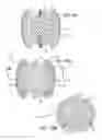 Fig. 30 - Multiple layer filamentary devices for treatment of vascular defects