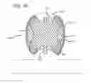 Fig. 31 - Multiple layer filamentary devices for treatment of vascular defects