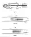 Fig. 15 - Retrieval systems and methods for use thereof