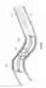 Fig. 20 - Retrieval systems and methods for use thereof