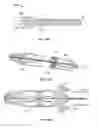Fig. 30 - Retrieval systems and methods for use thereof