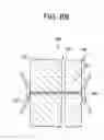Fig. 06 - Patent foramen ovale closure method