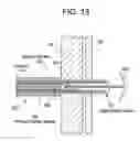 Fig. 22 - Patent foramen ovale closure method
