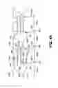 Fig. 05 - Variable denier yarn and suture
