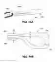 Fig. 22 - Variable denier yarn and suture