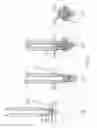Fig. 05 - Method and device for fixating a suture anchor with a suture in hard tissue