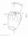 Fig. 13 - SPINE SURGERY METHOD AND IMPLANT DEPLOYMENT