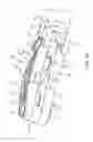 Fig. 17 - SPINE SURGERY METHOD AND IMPLANT DEPLOYMENT