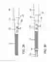 Fig. 24 - SPINE SURGERY METHOD AND IMPLANT DEPLOYMENT