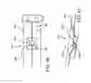 Fig. 30 - SPINE SURGERY METHOD AND IMPLANT DEPLOYMENT