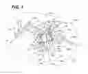 Fig. 02 - Method for performing minimally invasive surgery