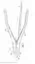 Fig. 02 - Expansion and compression instrument for fracture fixation