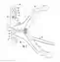 Fig. 08 - Expansion and compression instrument for fracture fixation