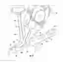 Fig. 10 - Expansion and compression instrument for fracture fixation
