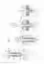 Fig. 02 - Device and method for fixating a suture anchor with a suture or a headed anchor in hard tissue