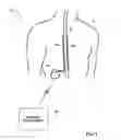 Fig. 02 - Recharge coupling efficiency for patient posture state