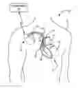 Fig. 01 - Isolating lead conductor for fault detection