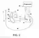 Fig. 03 - Methods and devices for accurately classifying cardiac activity