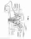 Fig. 03 - Bilateral electrical stimulation therapy for bladder dysfunction