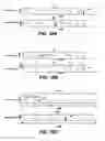 Fig. 10 - Bilateral electrical stimulation therapy for bladder dysfunction