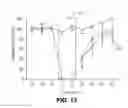 Fig. 13 - Bilateral electrical stimulation therapy for bladder dysfunction