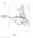 Fig. 02 - Stimulation therapy including substantially simultaneous bilateral stimulation