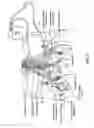 Fig. 03 - Stimulation therapy including substantially simultaneous bilateral stimulation