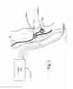 Fig. 02 - Apparatus for functional electrical stimulation of the body
