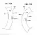 Fig. 23 - Cuff electrode having tubular body with controlled closing force