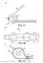 Fig. 07 - Percutaneous placement of electrodes