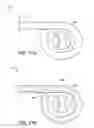 Fig. 12 - Percutaneous placement of electrodes