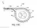Fig. 14 - Percutaneous placement of electrodes
