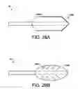 Fig. 32 - Percutaneous placement of electrodes
