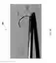 Fig. 38 - Percutaneous placement of electrodes