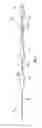 Fig. 04 - Vascular delivery system and method