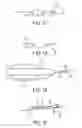 Fig. 06 - BALLOON CATHETER WITH INTEGRATED STOP FEATURE FOR PRECISE STENT PLACEMENT, FOR OSTIAL, RENAL AND OTHER LOCATIONS